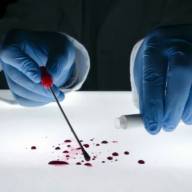 Se aprobó un nuevo protocolo para la obtención de muestras biológicas