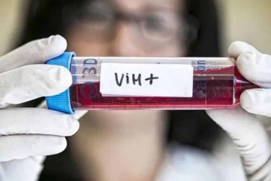 Crece el VIH en Argentina: aumento de casos y diagnósticos que llegan demasiado tarde