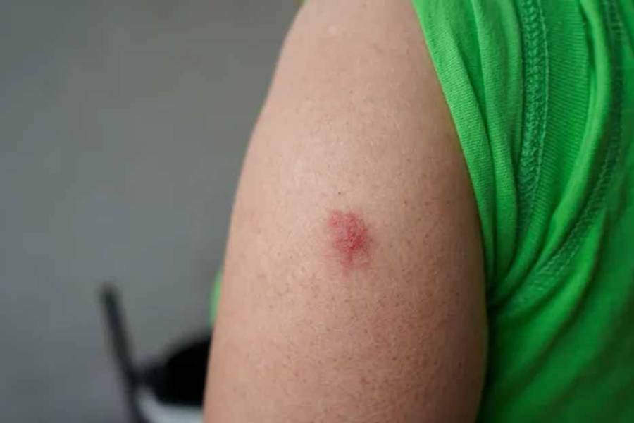 Cómo reconocer al barigüí, la mosca 