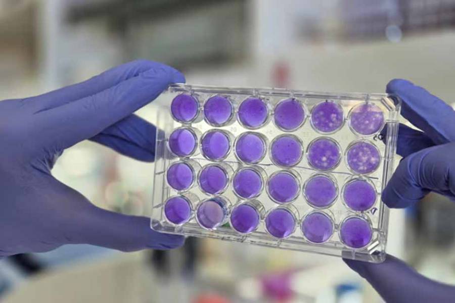 Argentinos hallan que dengue, Zika y fiebre amarilla se replican del mismo modo: se viene un antiviral
