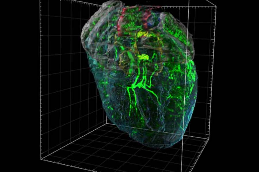 Descubren que el corazón tiene un pequeño “cerebro” que lo protege del estrés