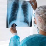 Concluyeron las medidas de cuarentena en la región rusa de Irkutsk tras la muerte de una laboratorista