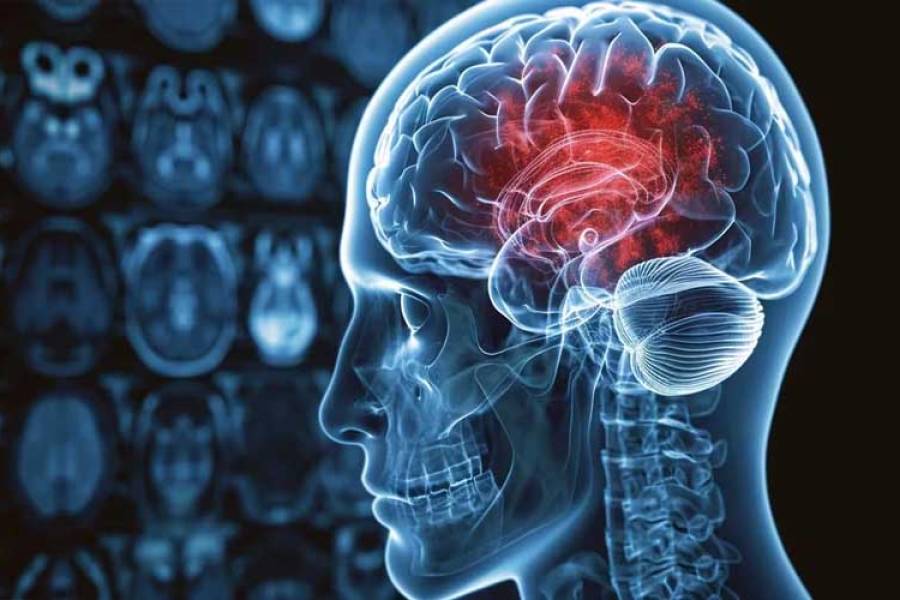 Por primera vez, un implante cerebral entrenado con IA permitió a un paciente sin habla comunicarse en inglés y español
