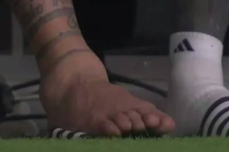 Impactante: la imagen del tobillo de Lionel Messi